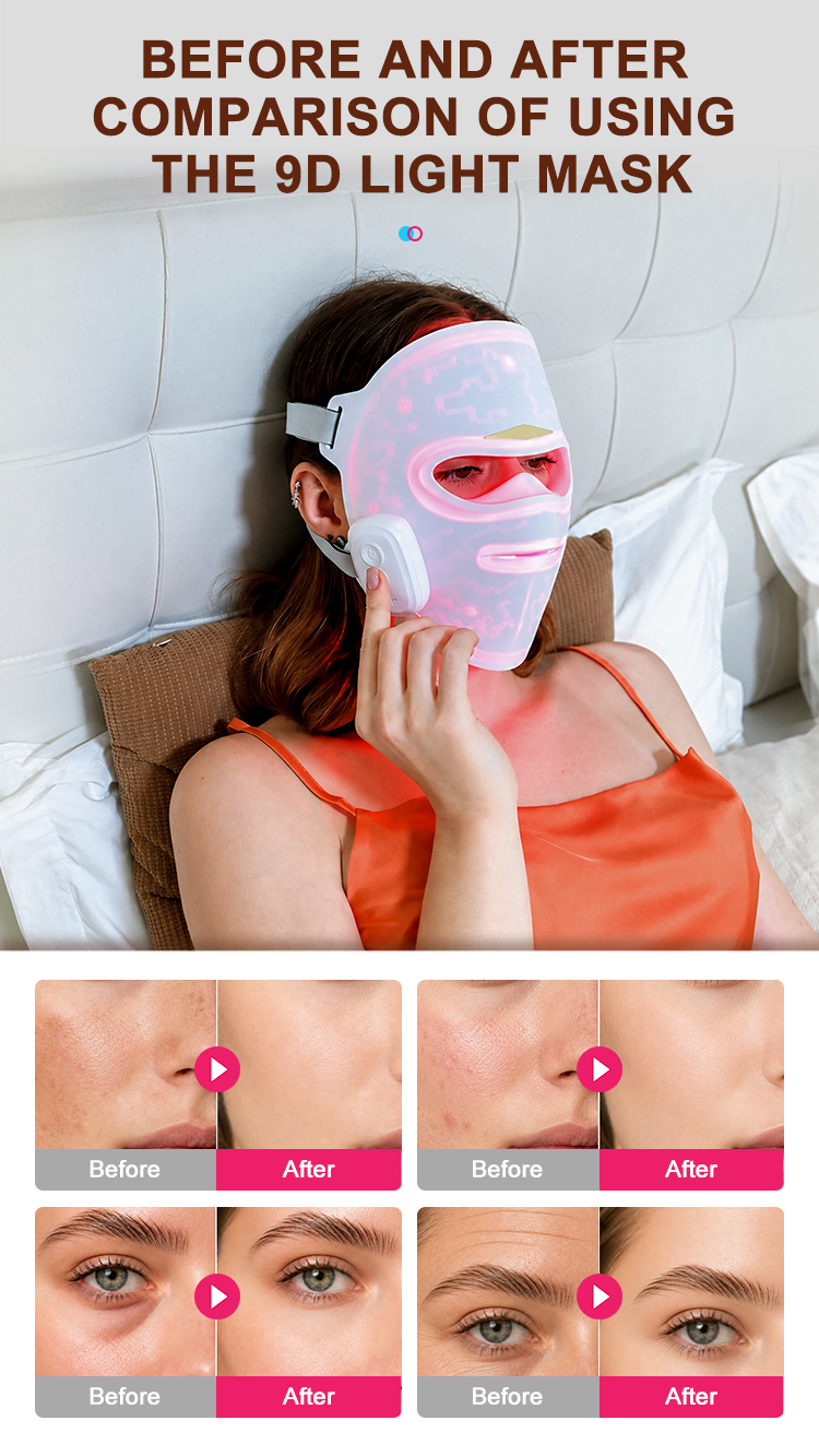 9D Multi-spectrum LED Face Mask – 4-in-1 Light Therapy for Home Use